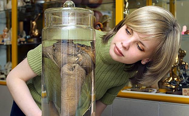 Casquería de famoso | Hoy